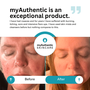 myAuthentic Hypochlorous Mist & Cleanser Travel Duo