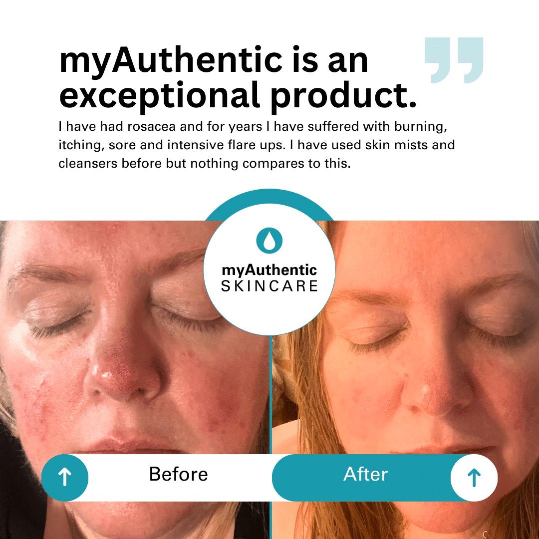 myAuthentic Hypochlorous Mist & Cleanser Travel Duo